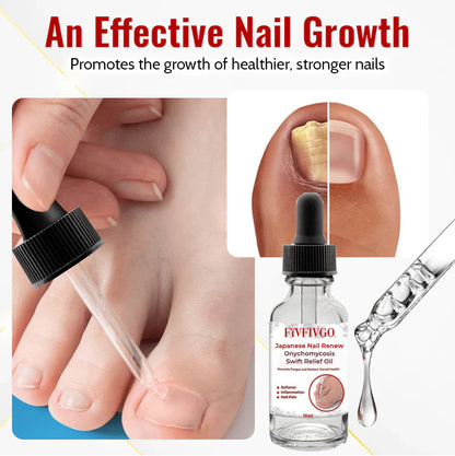 FIVFIVGO™ JAPANESE NAIL RENEW ONYCHOMYCOSIS SWIFT RELIEF OIL