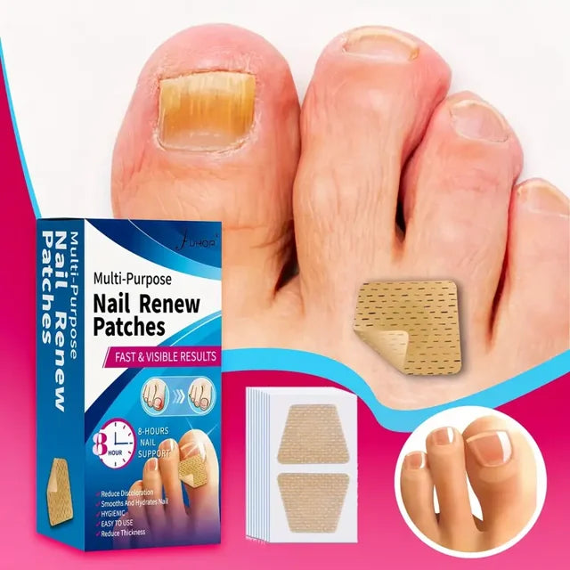 64PCS FUNGUS NAIL REPAIR AND STRENGTHENING PATCHES