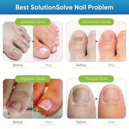 72 PCS NAIL PROTECT PATCHES | TOENAIL MAXIMUM STRENGTH