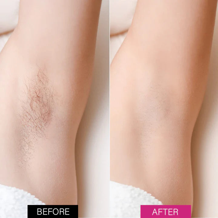 FIVFIVGO™ BEESILK HAIR REMOVAL MOUSSE