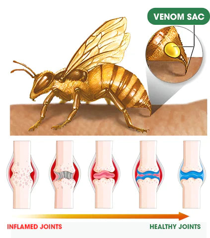 FIVFIVGO™ BEE VENOM ADVANCED JOINT AND BONE THERAPY CREAM